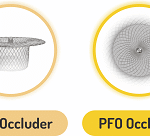 SMT Celebrates 20 Years of the Cocoon Occluder Journey, Transforming Lives in Congenital and Structural Heart Defects